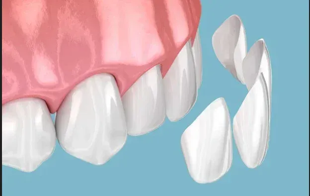 Cosmetic dentistry and veneers service card — Root Care Dental Clinic, Gurugram