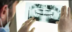 Dental X-ray and general dentistry service card — Root Care Dental Clinic, Sector 49 Gurugram