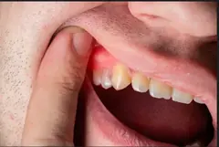 Emergency dental care service card — Root Care Dental Clinic, Sector 49 Gurugram