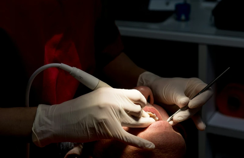 Teeth cleaning at Root Care Dental Clinic, Gurugram