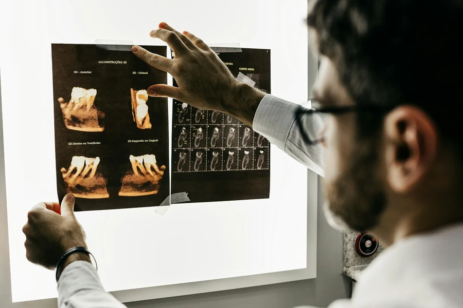 Infected or abscessed tooth — root canal treatment symptoms in Gurugram